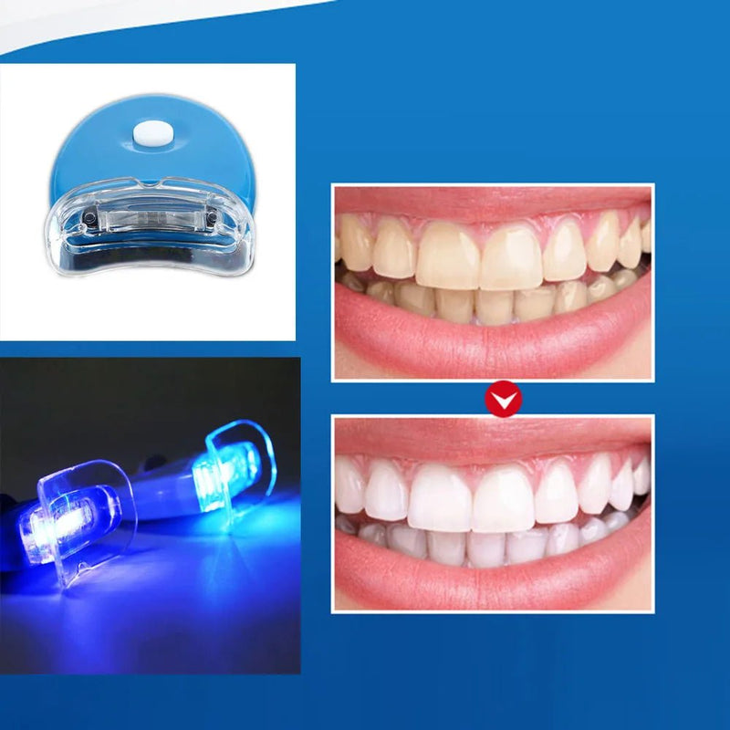Clareamento Dentário com Luz LED Max White | Sorriso Branco com Tecnologia Profissional em Casa - The Miner Shop